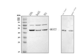 Anti-MGAT2 Antibody