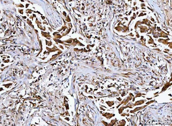 Anti-MFAP3 Antibody
