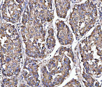 Anti-MFAP3 Antibody