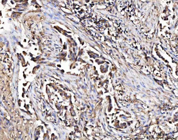 Anti-MARK3 Antibody