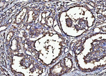 Anti-MARK3 Antibody