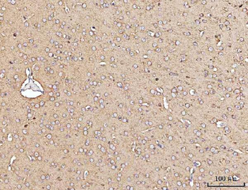 Anti-MARK3 Antibody