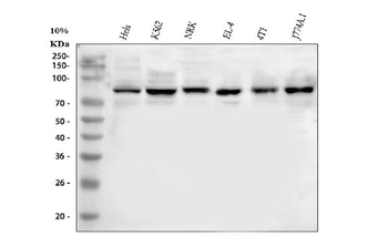 Anti-MARK3 Antibody