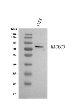 Anti-MAGEC3 Antibody