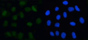 Anti-MAD2L2 Antibody