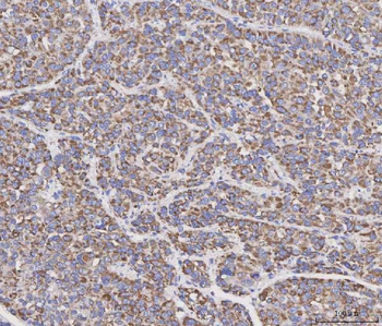 Anti-MAD2L2 Antibody