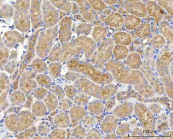 Anti-NUDT6 Antibody