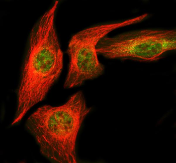 Anti-NUDT5 Antibody