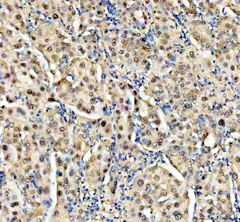 Anti-NUDT5 Antibody