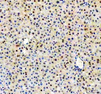 Anti-NUDT5 Antibody