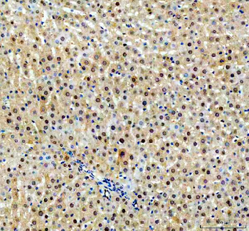Anti-NUDT5 Antibody