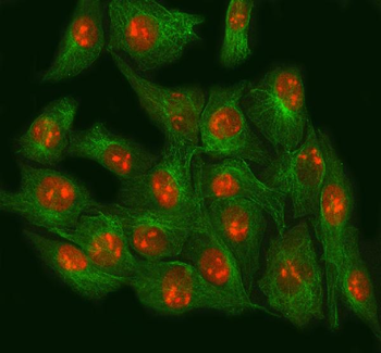 Anti-NSUN2 Antibody