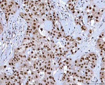 Anti-NSUN2 Antibody