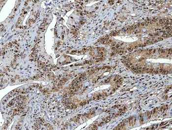 Anti-NSUN2 Antibody