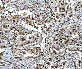 Anti-NSUN2 Antibody