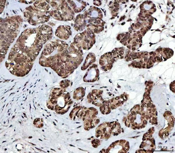 Anti-NSUN2 Antibody