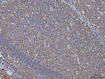 Anti-NSUN2 Antibody