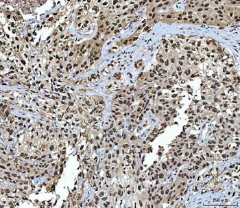 Anti-NSUN2 Antibody