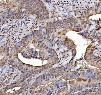 Anti-NELF/NSMF Antibody