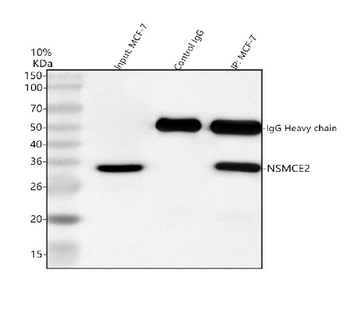 Anti-NSMCE2 Antibody
