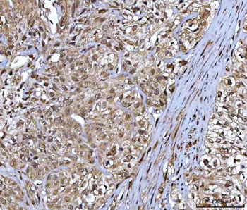 Anti-NR5A2 Antibody