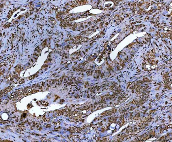 Anti-NR5A2 Antibody
