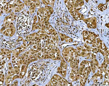 Anti-NR5A2 Antibody