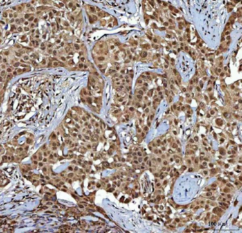 Anti-NR2C2 Antibody
