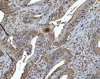 Anti-NR2C2 Antibody