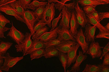 Anti-MED26 Antibody