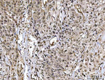 Anti-MED26 Antibody