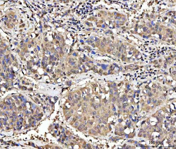 Anti-MED26 Antibody
