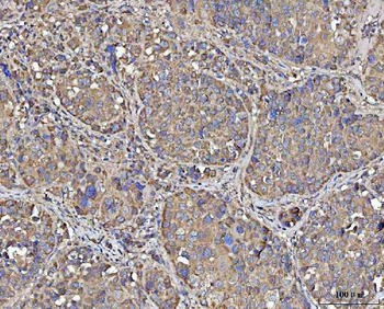 Anti-MECR Antibody