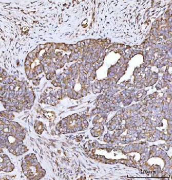 Anti-MECR Antibody