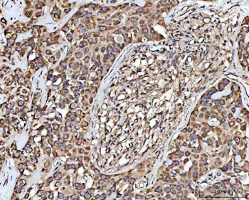 Anti-MECR Antibody