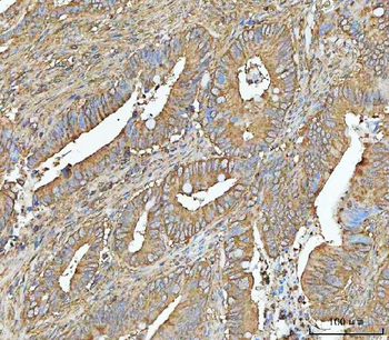 Anti-NT5C Antibody