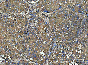 Anti-NT5C Antibody