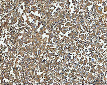 NT5C Antibody