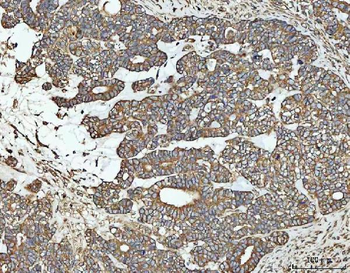 Anti-NT5C Antibody