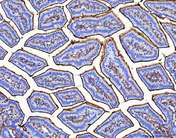 Anti-MGAM Antibody