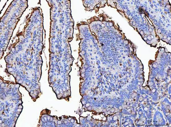 Anti-MGAM Antibody