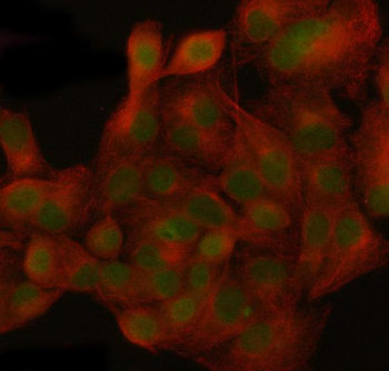 Anti-NUP155 Antibody