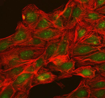 Anti-NUP54 Antibody