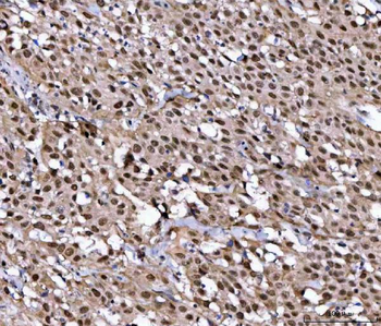 Anti-NUP37 Antibody