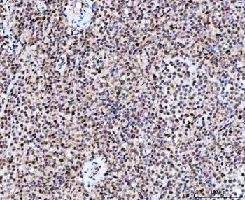 Anti-NUP37 Antibody