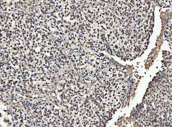 Anti-NUMA/NUMA1 Antibody