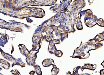 Anti-NUDCD3 Antibody