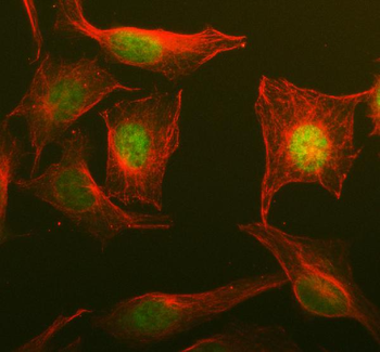 Anti-NOSIP Antibody