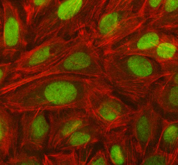 Anti-NOSIP Antibody