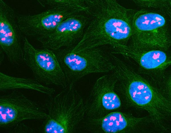 Anti-NOP2 Antibody